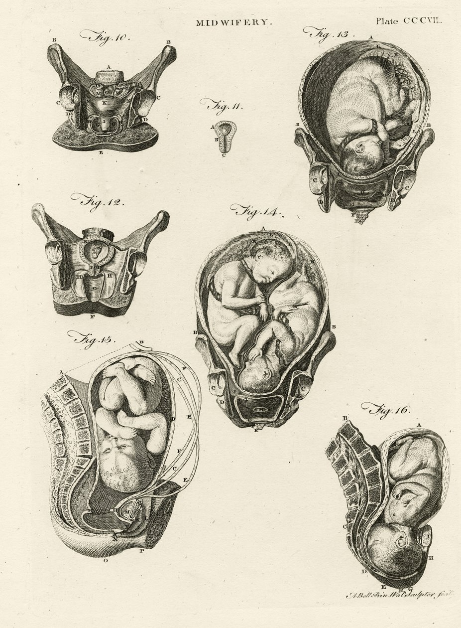 Obstétrique, illustration de 