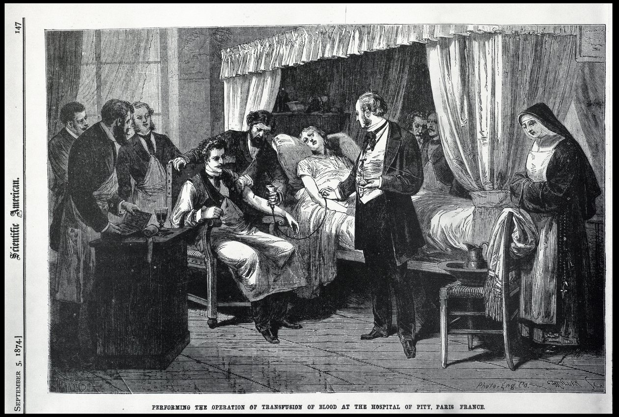 Opération de la transfusion de sang à l