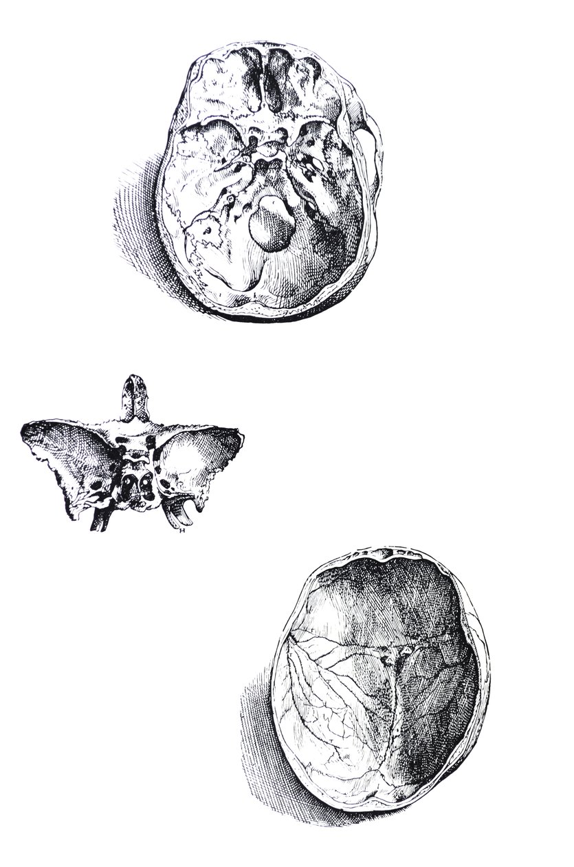 Les planches du premier livre de De Humani Corporis Fabrica - Andreas Vesalius