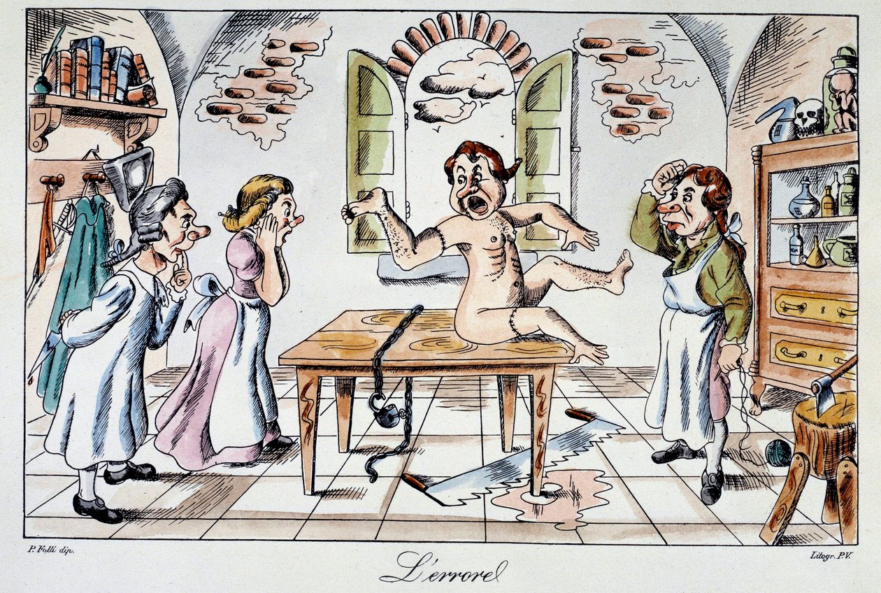 Erreur chirurgicale : un autocollant satirique représentant les risques encourus par les patients livrés aux mains de mauvais médecins, un exemple de greffe de bras à la place de la jambe. Gravure du 19e siècle - Anonymous Anonymous