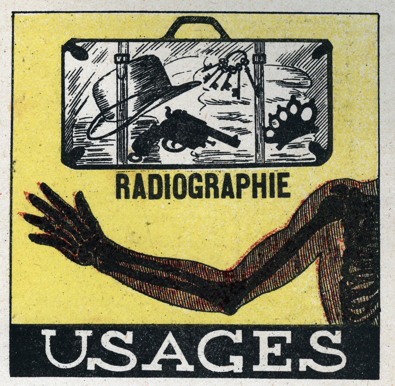 Rayons X : utilisation des rayons X pour voir à travers les objets et les corps. Illustration anonyme de 1925. Collection privée. - Anonymous Anonymous