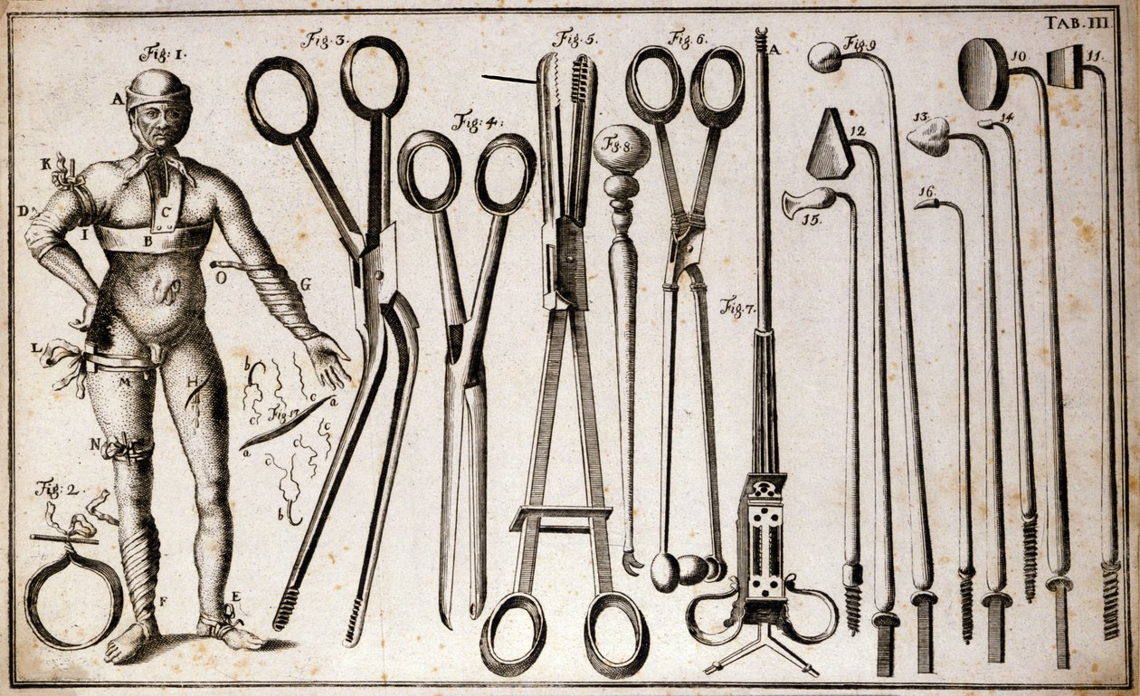 Différents types de pinces et instruments chirurgicaux. Un homme portant différents types de tourniquets et bandages. Planche de chirurgie illustrée par Benoist Louis Prevost (1735-1809). XVIIIe siècle - Benoit Louis Prevost