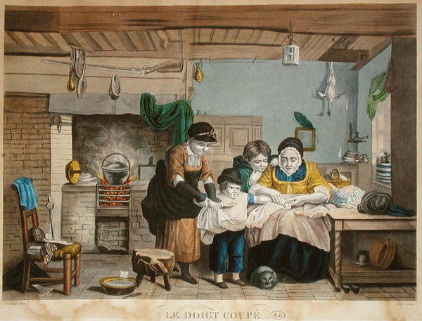 Le Doigt Coupé, gravé par Joly, vers 1830-40 - David (after) Wilkie