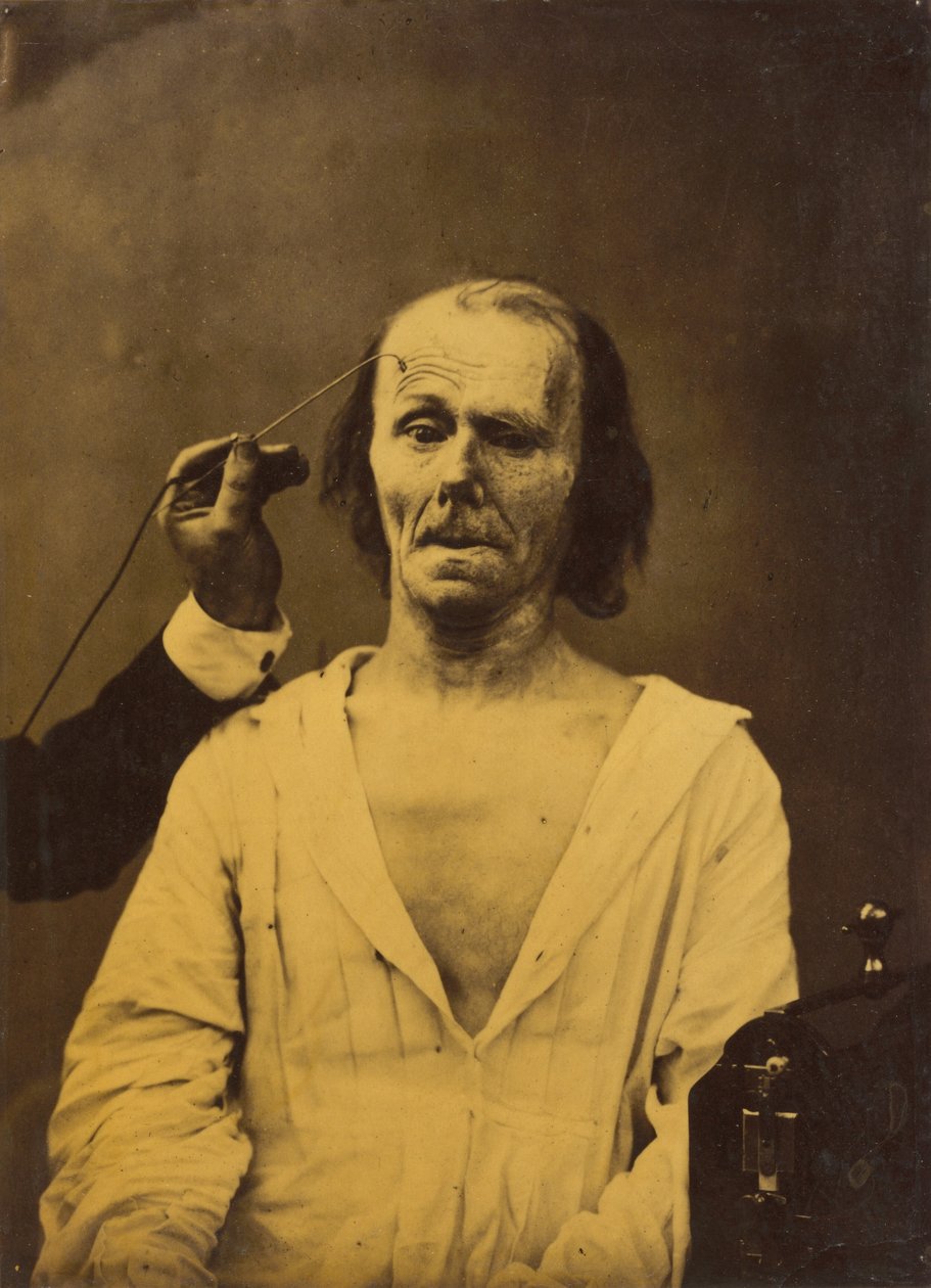 Un visage détendu à gauche, une attention profonde à droite, 1854-1856, imprimé en 1862 - Duchenne de Boulogne