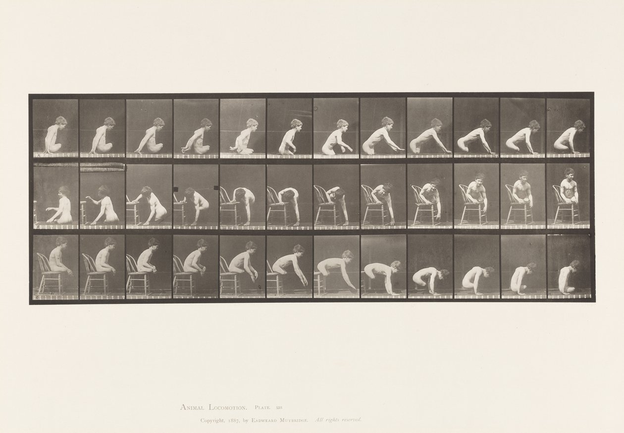 Planche 538. Amputation Double des Cuisses; Garçon; A, Avancer - Eadweard Muybridge
