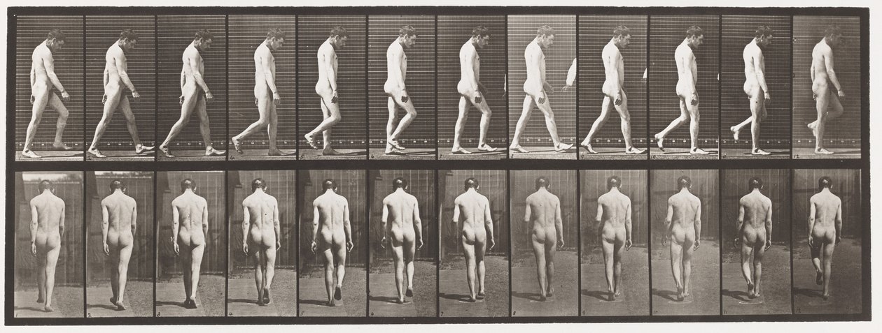 Planche 549. Épilepsie ; marche - Eadweard Muybridge