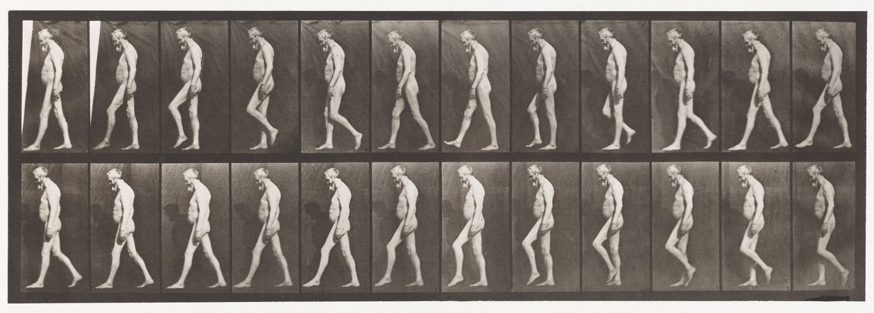 Planche 555. Atrophie musculaire des jambes; adulte, A,B, marche, 1885 - Eadweard Muybridge