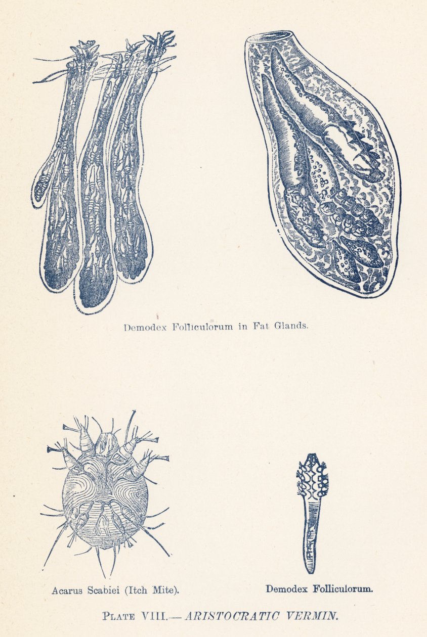 La vermine aristocratique (lithographie couleur) - English School