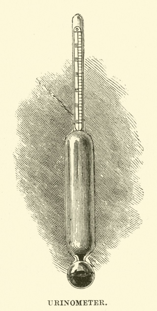 Urinomètre (gravure) - English School