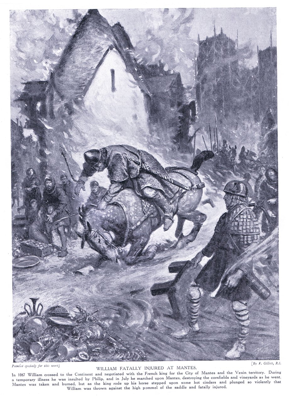 William grièvement blessé à Nantes, années 1920 - Frank Gillett