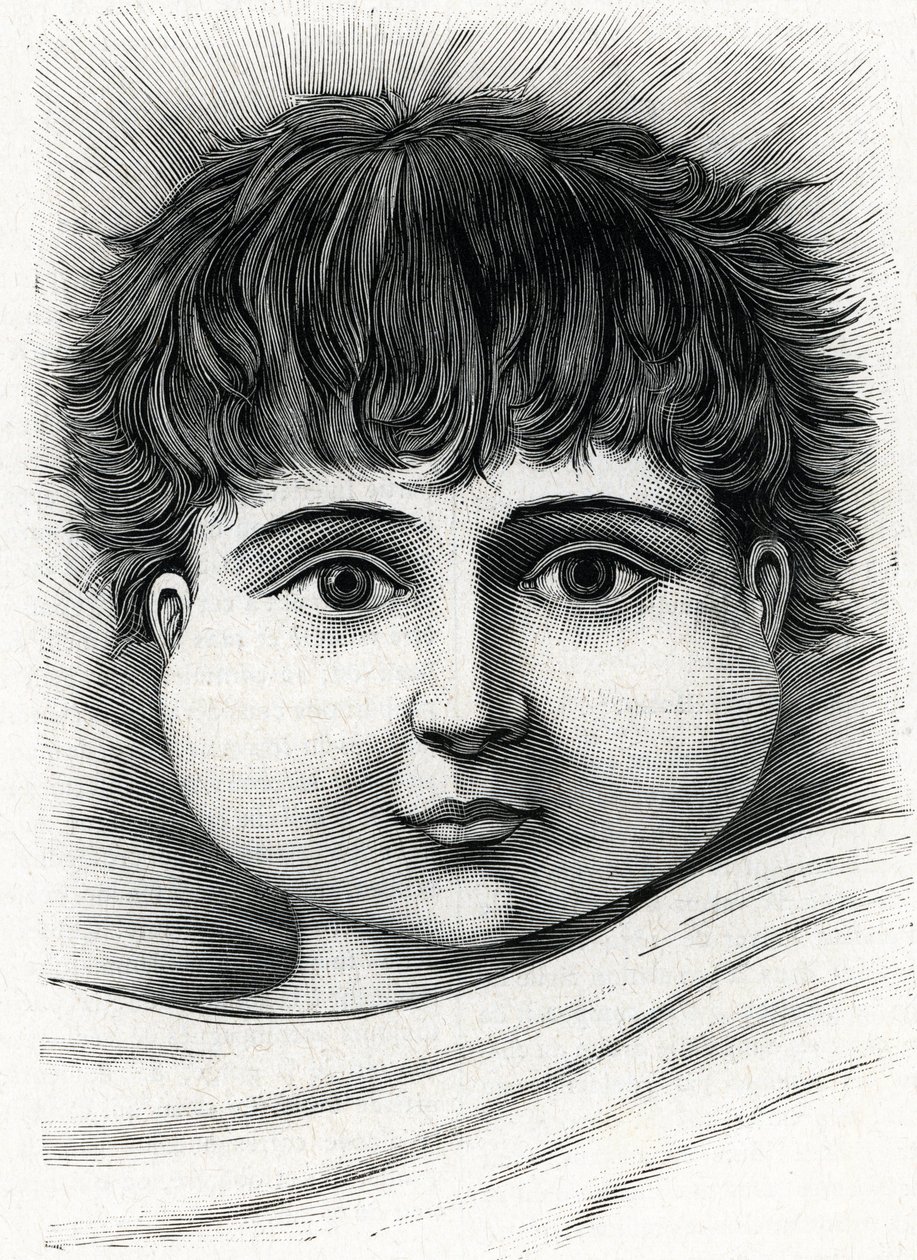 Enfant avec la maladie des oreillons (gravure) 1888 - French School