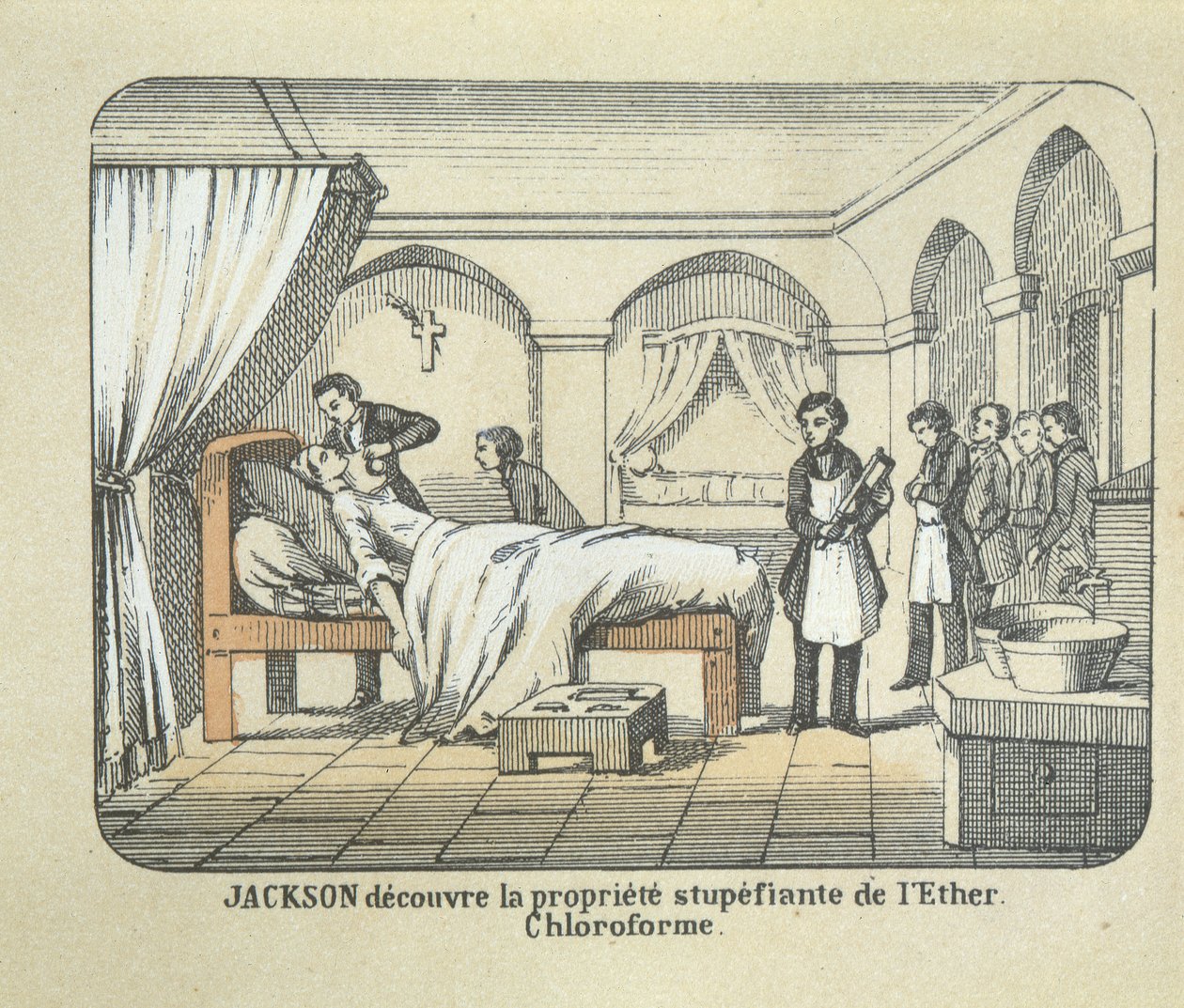 Dr Charles Jackson (1805-80) découvre les qualités anesthésiques de l