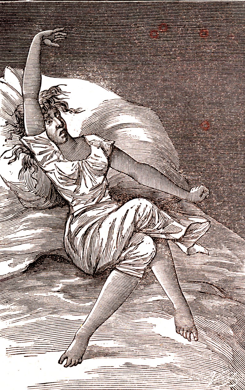 Maux de tête, mélancolie et hystérie, anxiété. 1887 (gravure) - French School