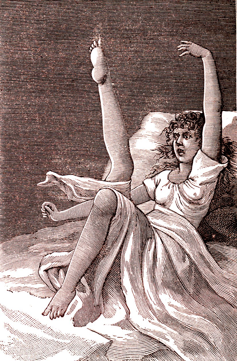Hystérie, un phénomène mental extrême, psychoses et psychonévroses. 1887 - French School