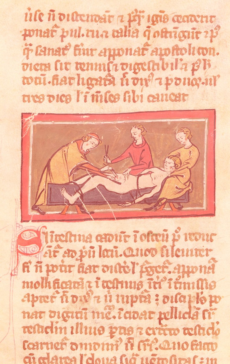 Ms H 89 fol.23 Chirurgie, d