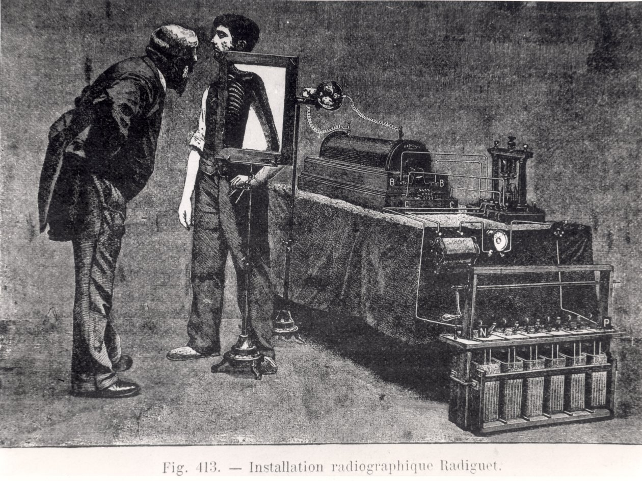 Machine à rayons X de Radiguet - French School
