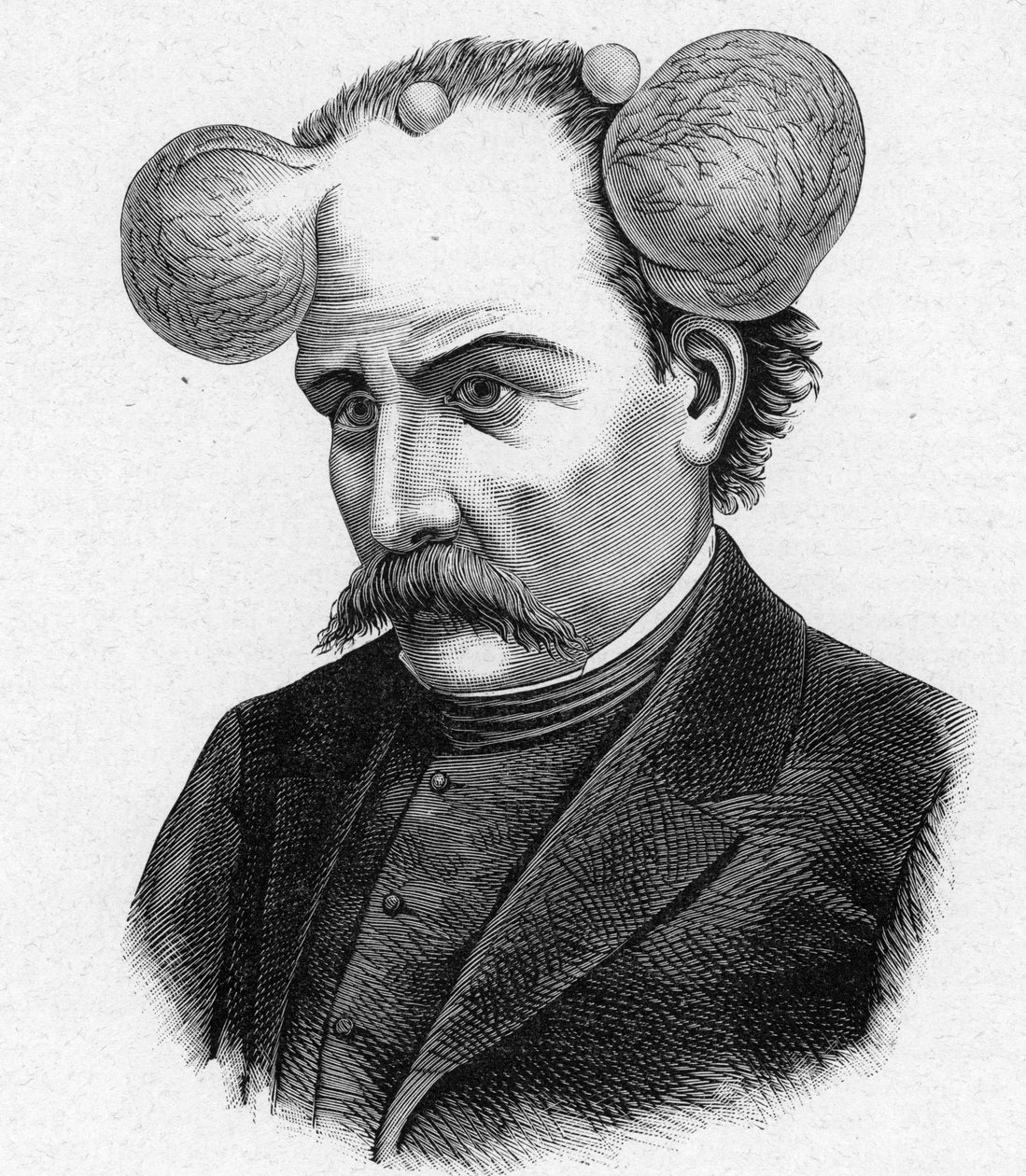Représentation d