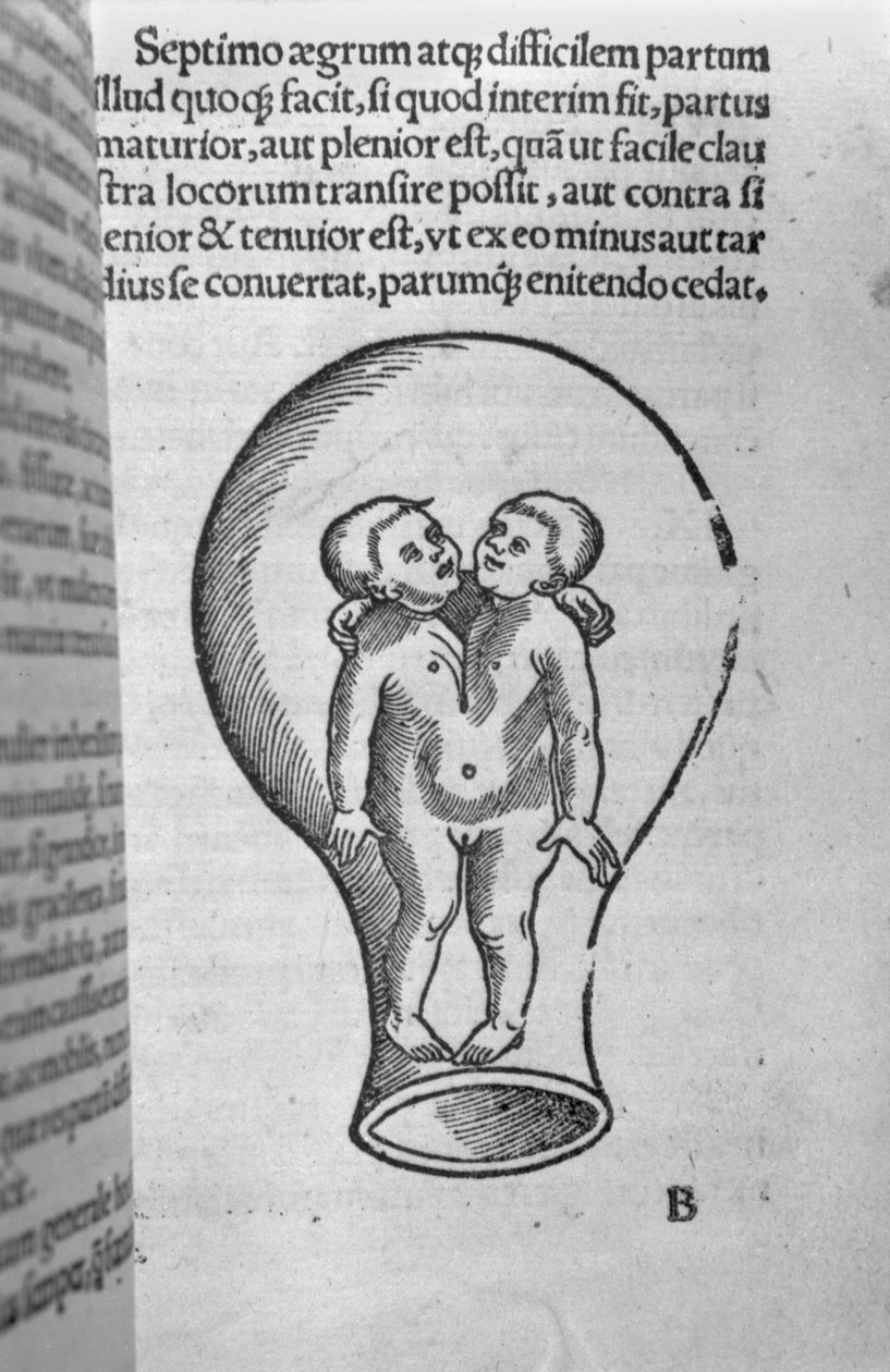 Enfants siamois, illustration du soi-disant manuscrit Rhodion - French School