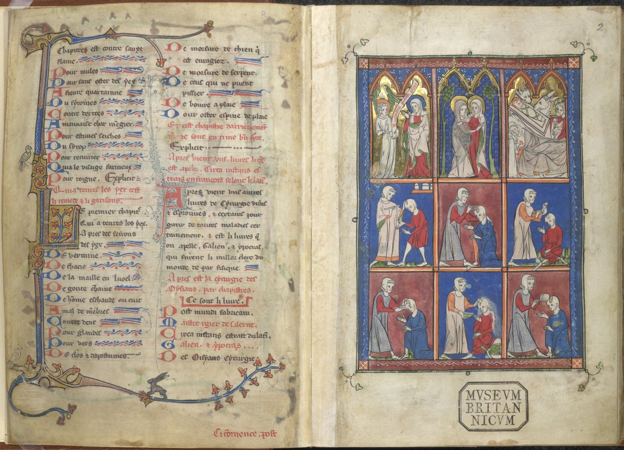 Sloane 1977,f.2 La Chirurgia: Scènes bibliques et médicales - French School