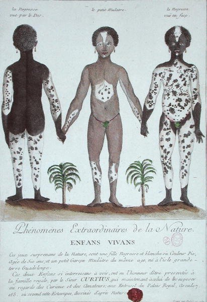 Le Phénomène de la Leucodermie - French School