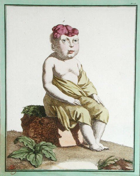 Enfant avec une Moitié de Tête, de 