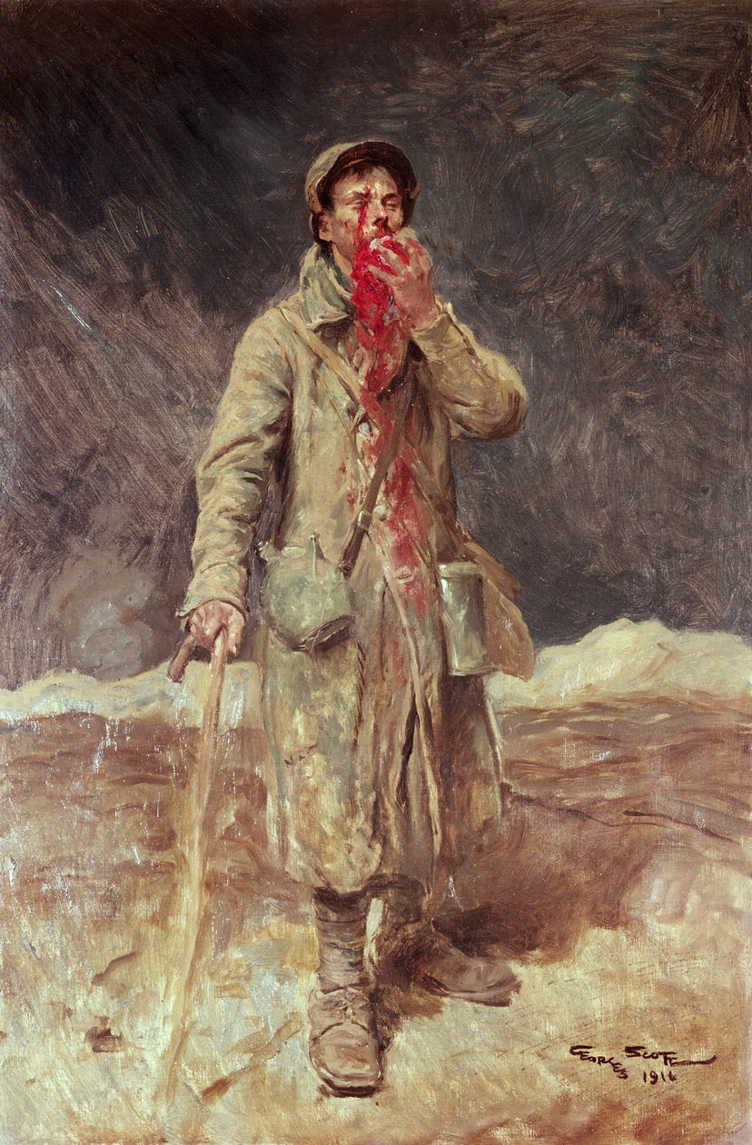 Un soldat blessé, 1916 - Georges Bertin Scott