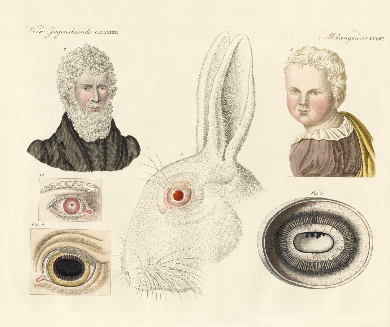 Albinos - German School