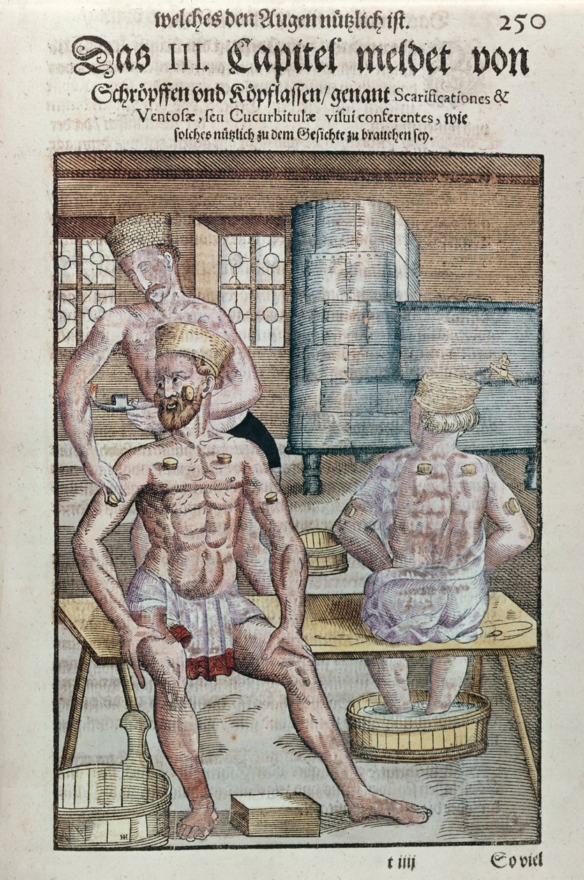 Ventouses, de Ophthalmodouleia par Georg Bartisch, publié à Dresde en 1583 - German School