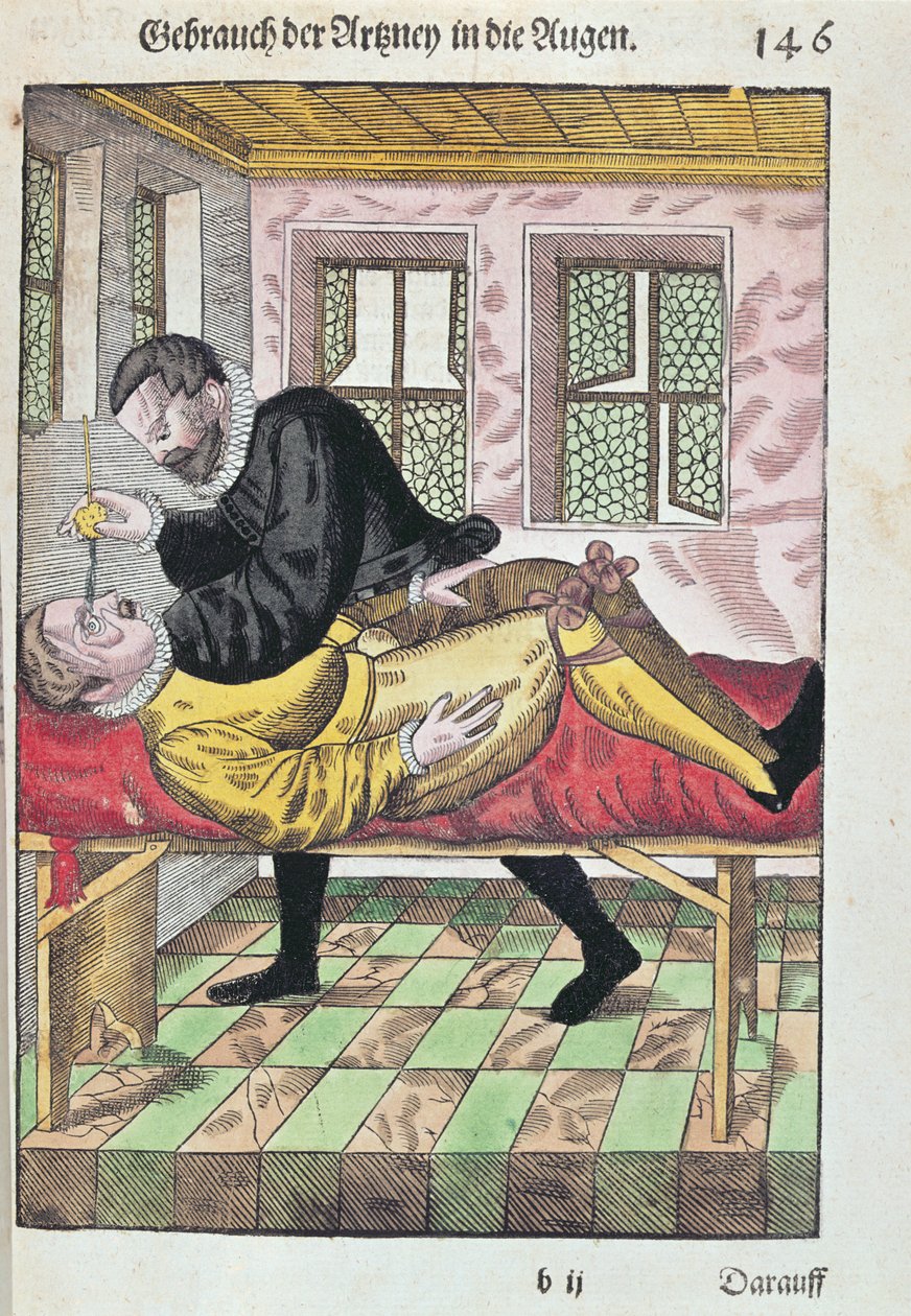 Opération de l