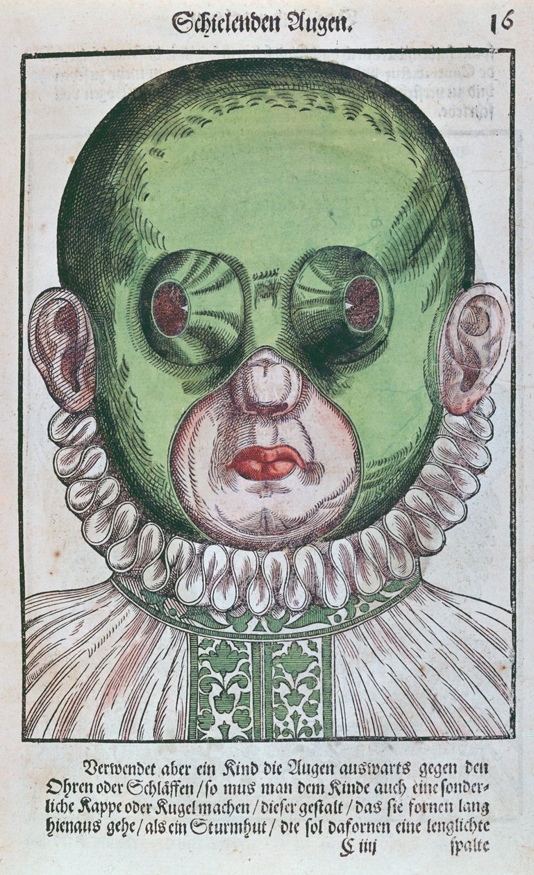 Masque pour traiter un strabisme, de l
