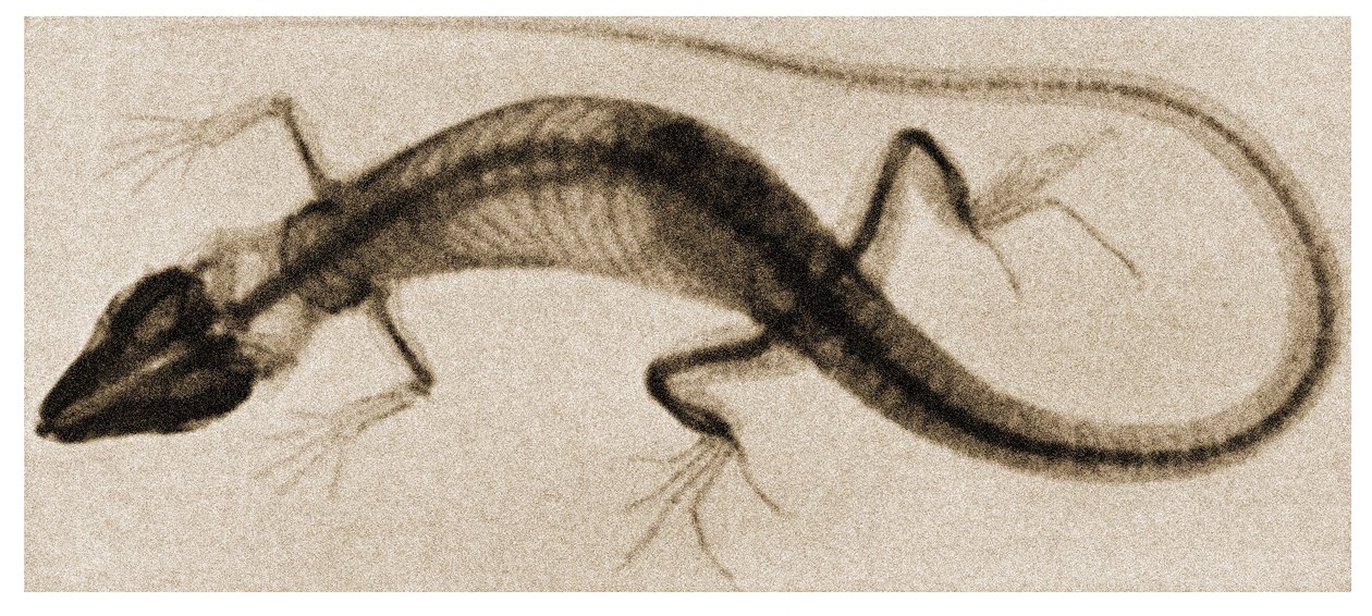Radiographie d