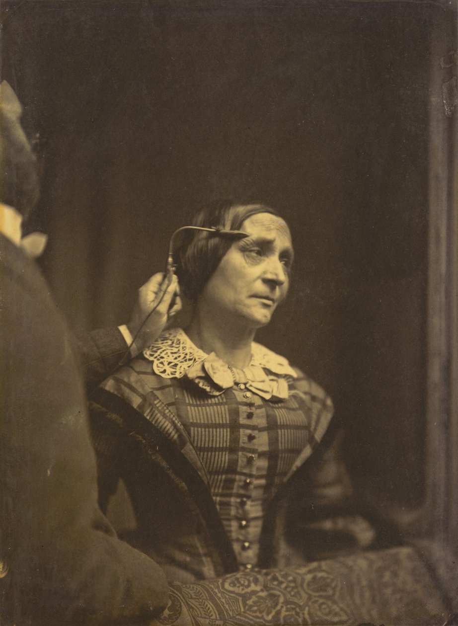 Attention, regard attentif (gauche); Attention douloureuse (droite) - Guillaume Benjamin Amant Duchenne