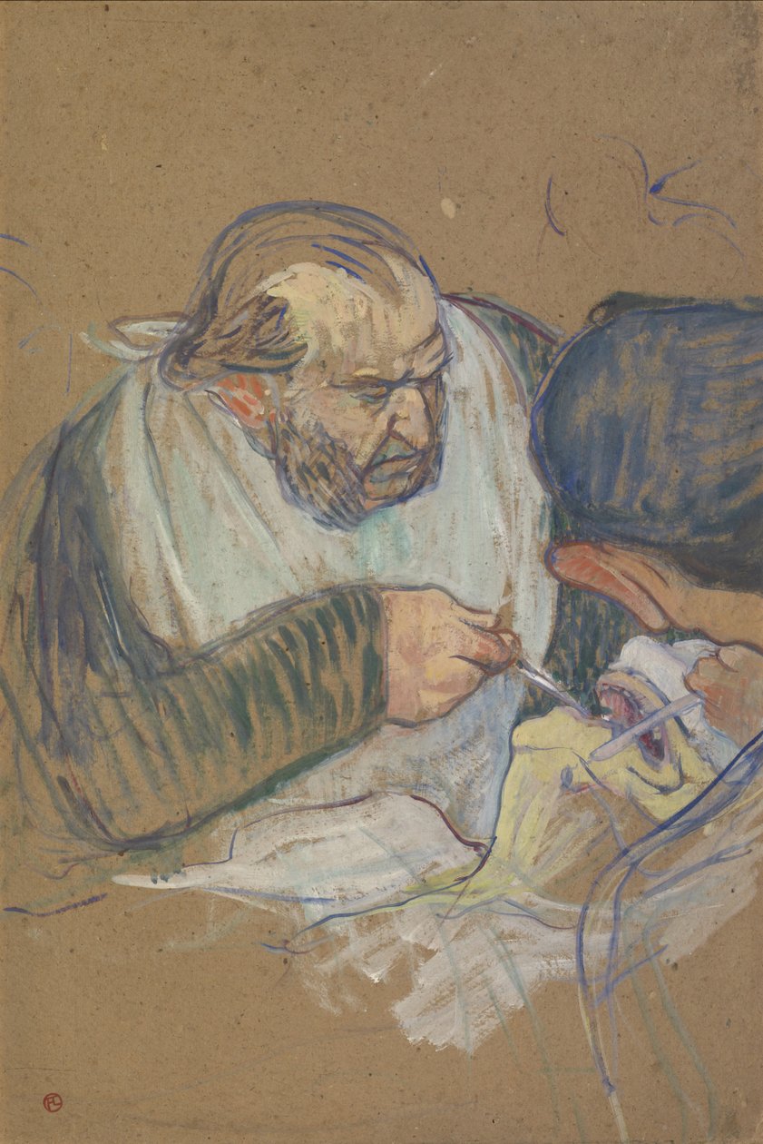 Le Dr Péan opérant, 1891-92 - Henri de Toulouse Lautrec