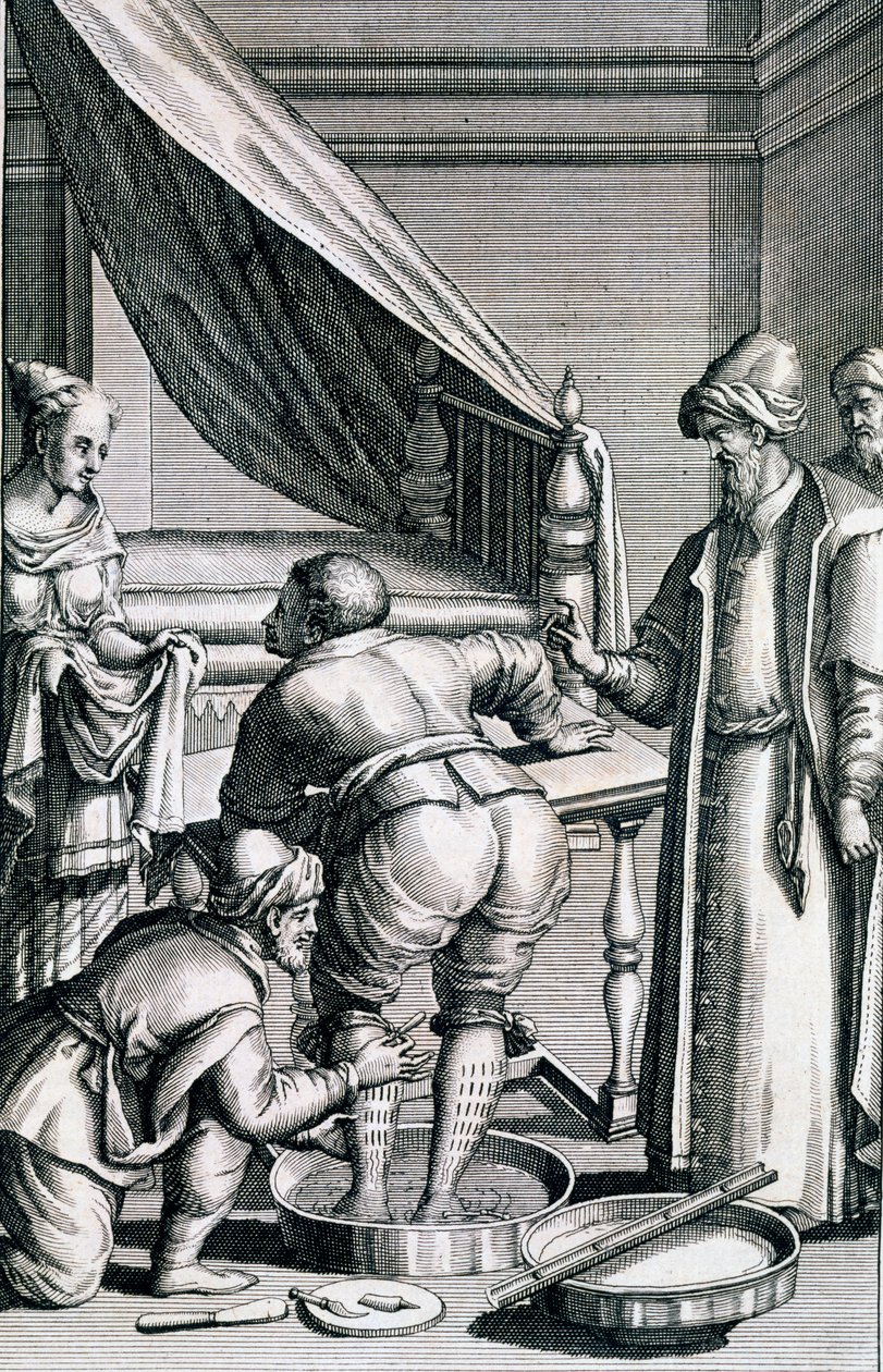 Saignée dans les jambes, de Medicina Aegyptiorum par Prospero Alpini, publié 1745 - Italian School