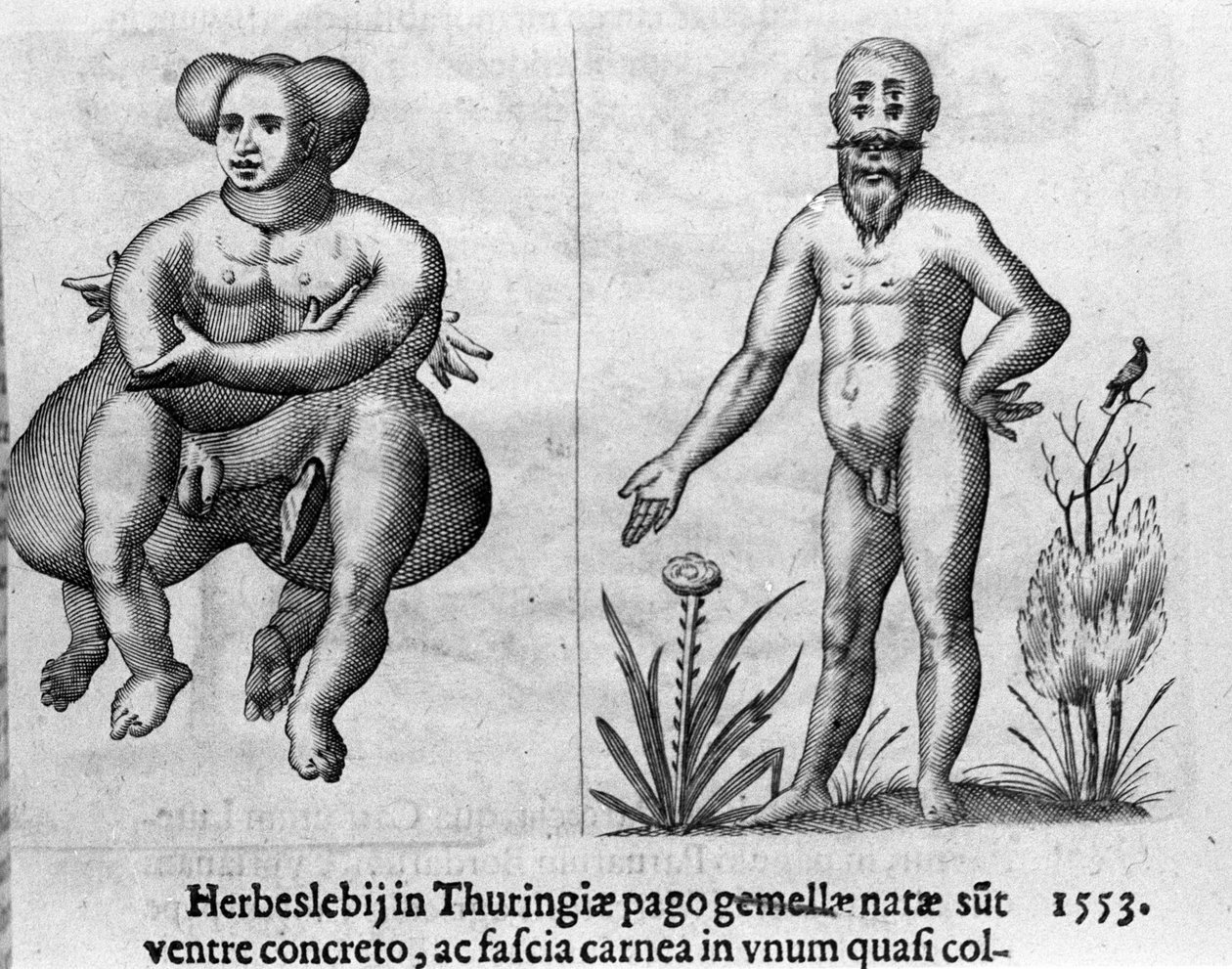 Différents types de monstres humains. Gravure de « De monstrorum natura, causis et differentiis » de Fortunio Liceti (1577-1656), scientifique italien. 1646 - Italian School