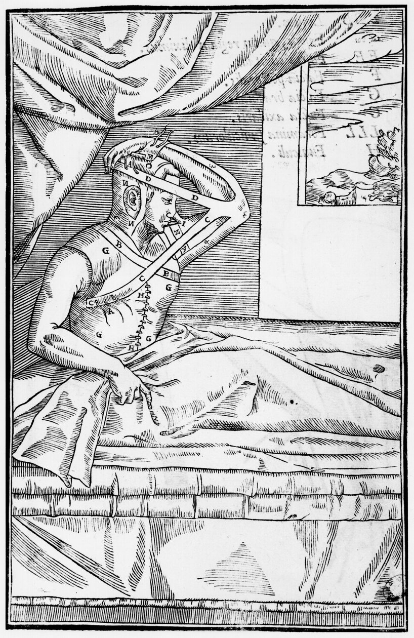 Chirurgie reconstructive du nez, illustration de De curtorum chirurgia per insitionem par Gaspare Tagliacozzi (1545-99) Venise, publié en 1597 - Italian School