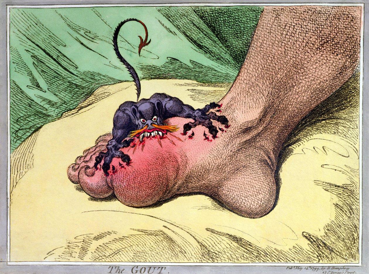 La goutte, publié par Hannah Humphrey en 1799 - James Gillray
