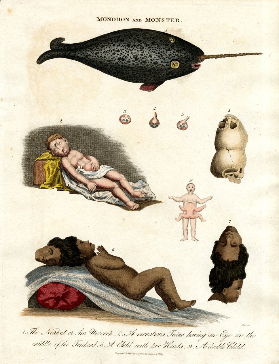 Narval et malformations - John Pass