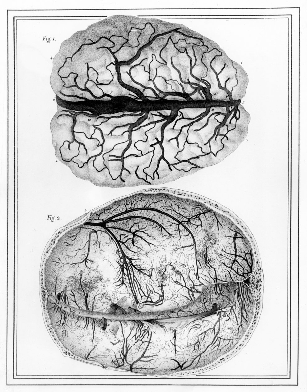 Le Cerveau, 1825 - Jules Germain Cloquet
