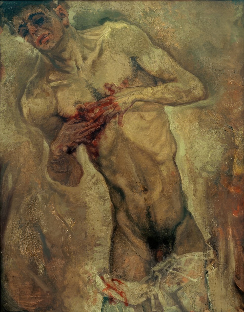 Celui qui saigne - Max Oppenheimer