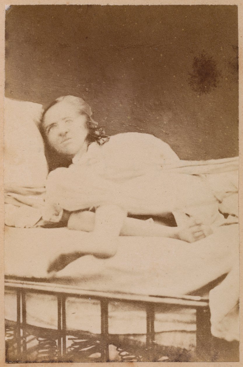 Épilepsie hystérique, contorsions, planche XXXVIII de 
