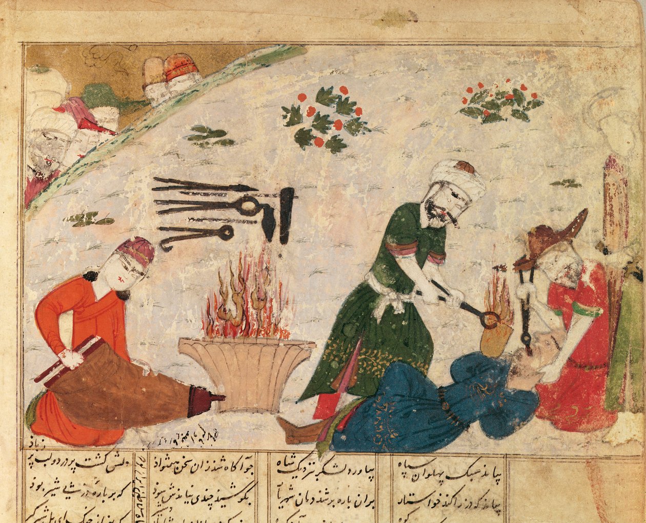 Ms Supp Pers 493 fol.363v Torture d