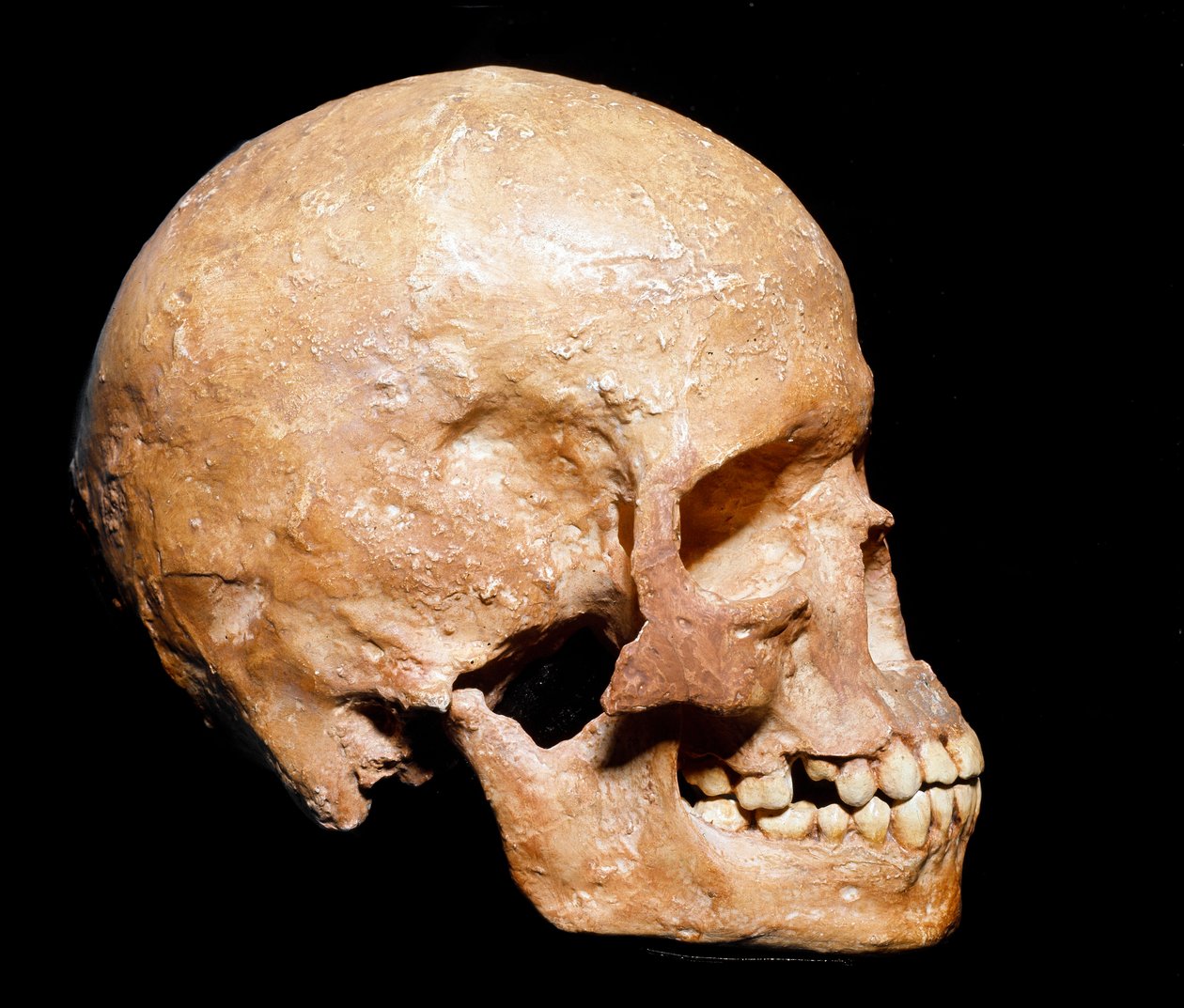Préhistoire : crâne fossile d