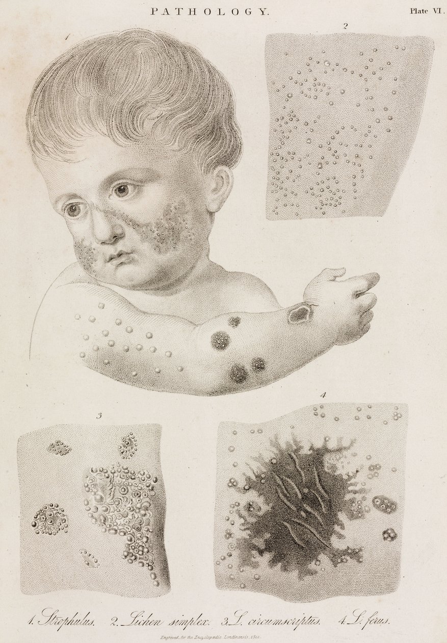 Dermatologie Types de maladies de la peau - John Pardon