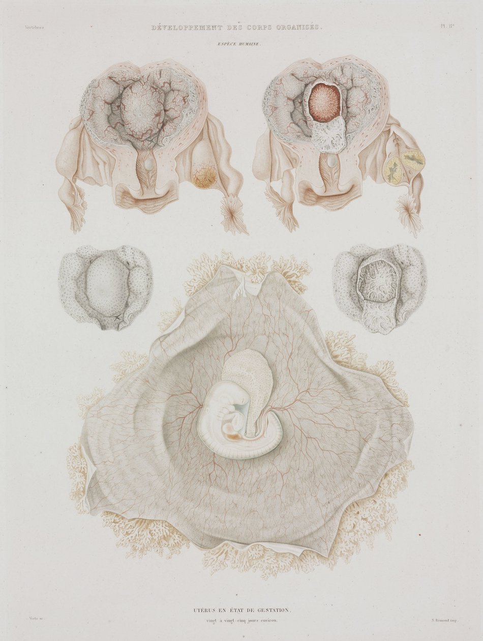 Gynécologie Utérus humain avec embryon, vers 1847-1859 - John Pardon