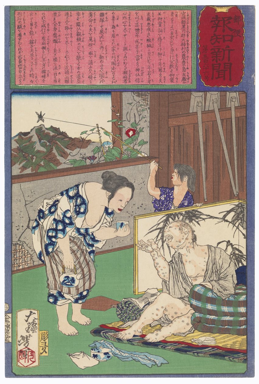 Toshima Tomiyo qui resta auprès de son mari lépreux, Tomozō - Tsukioka Yoshitoshi