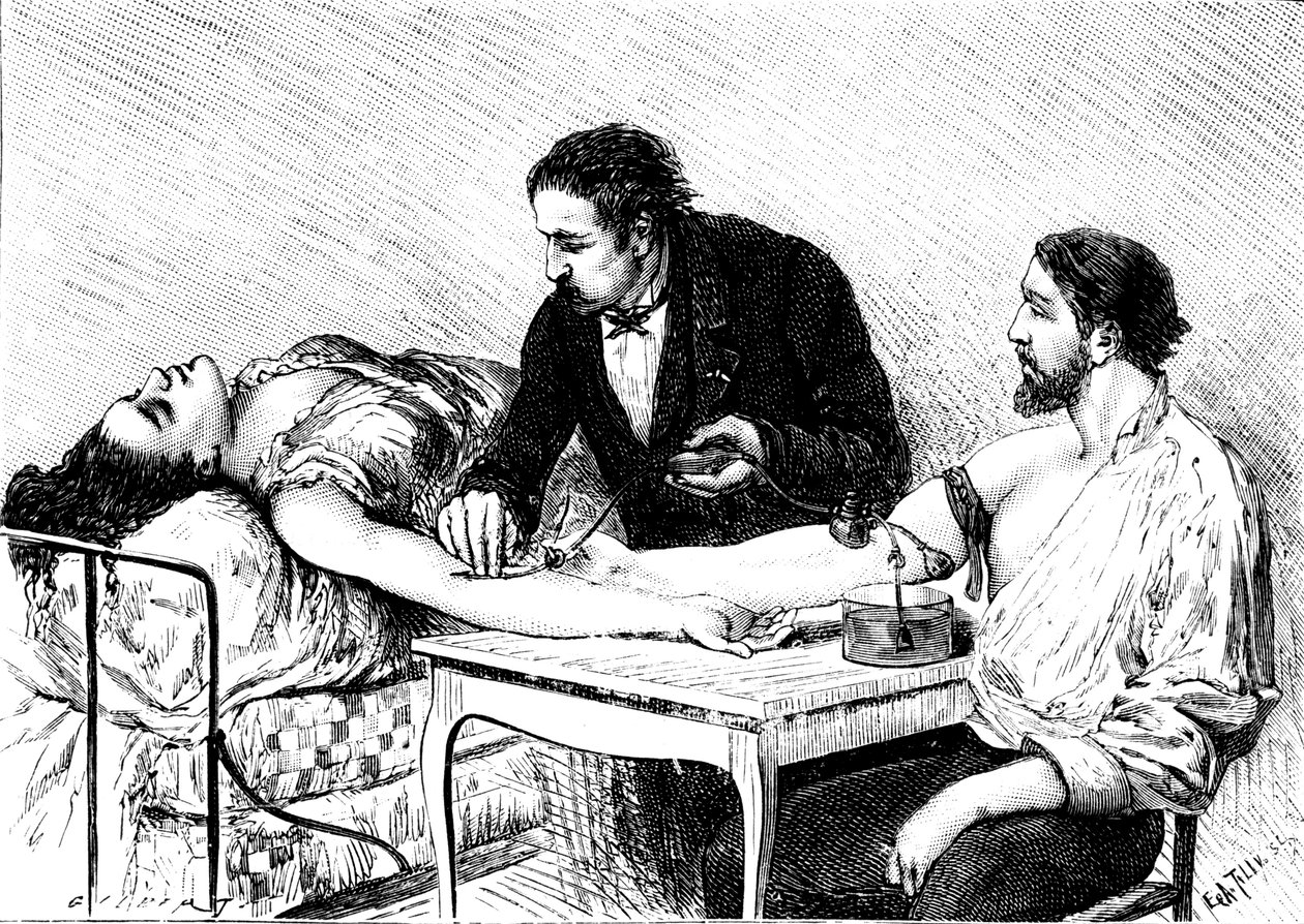 Le Dr Roussell de Genève effectuant une transfusion sanguine directe à une femme à partir d