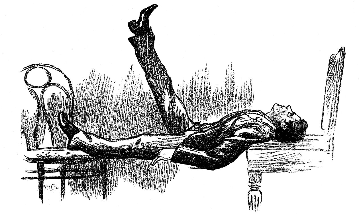 Sujet hypnotisé en état de catalepsie, 1891 - Unbekannt