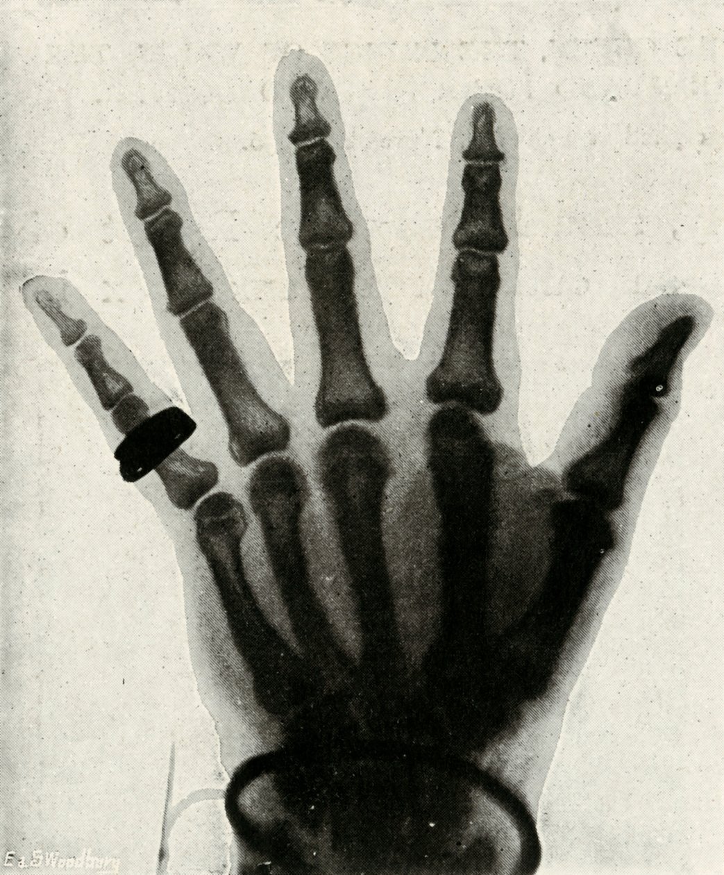 Radiographie de la main de S.A.R. le prince de Galles, vers 1897 - Unbekannt