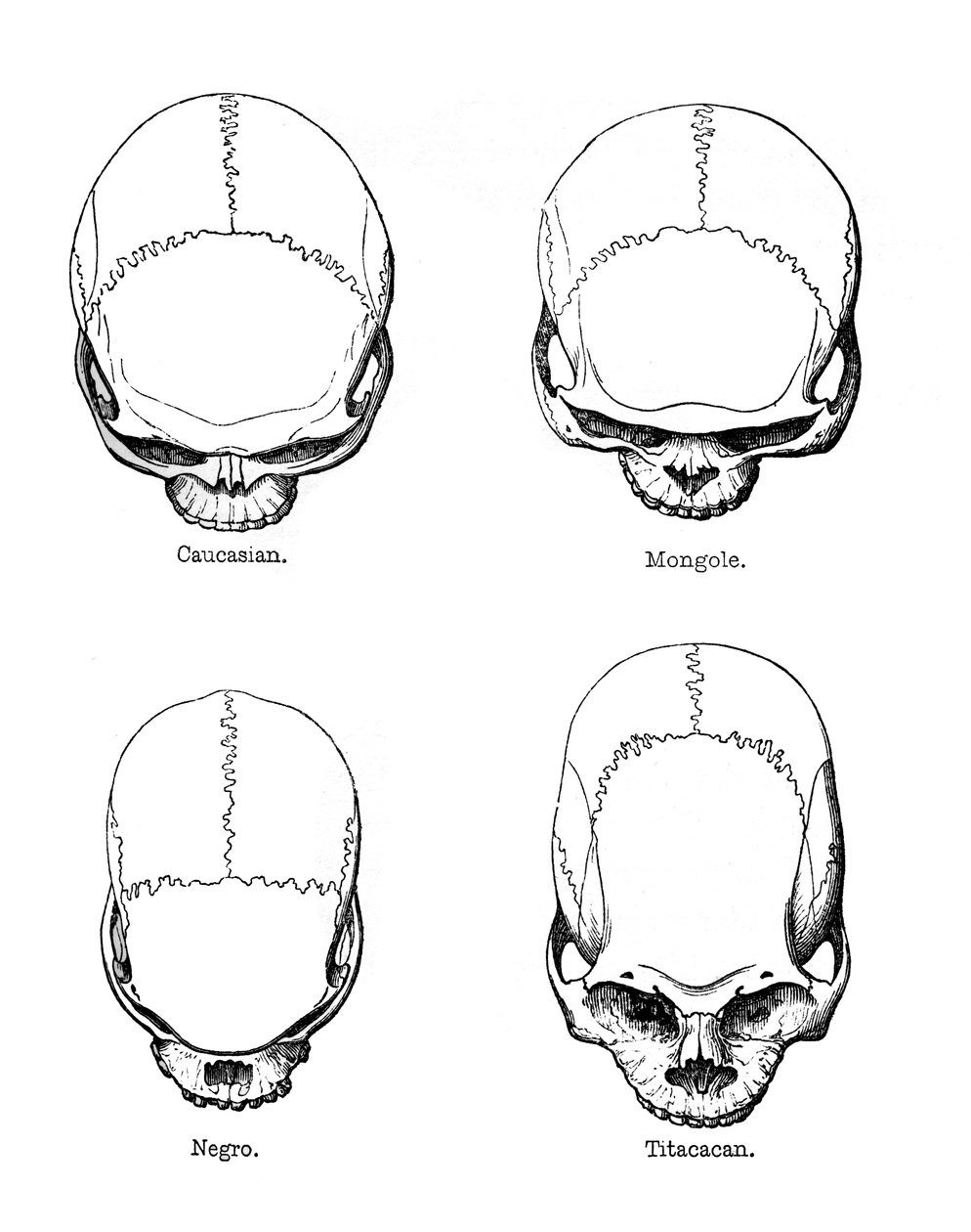 La configuration verticale du crâne, 1848 - Unbekannt